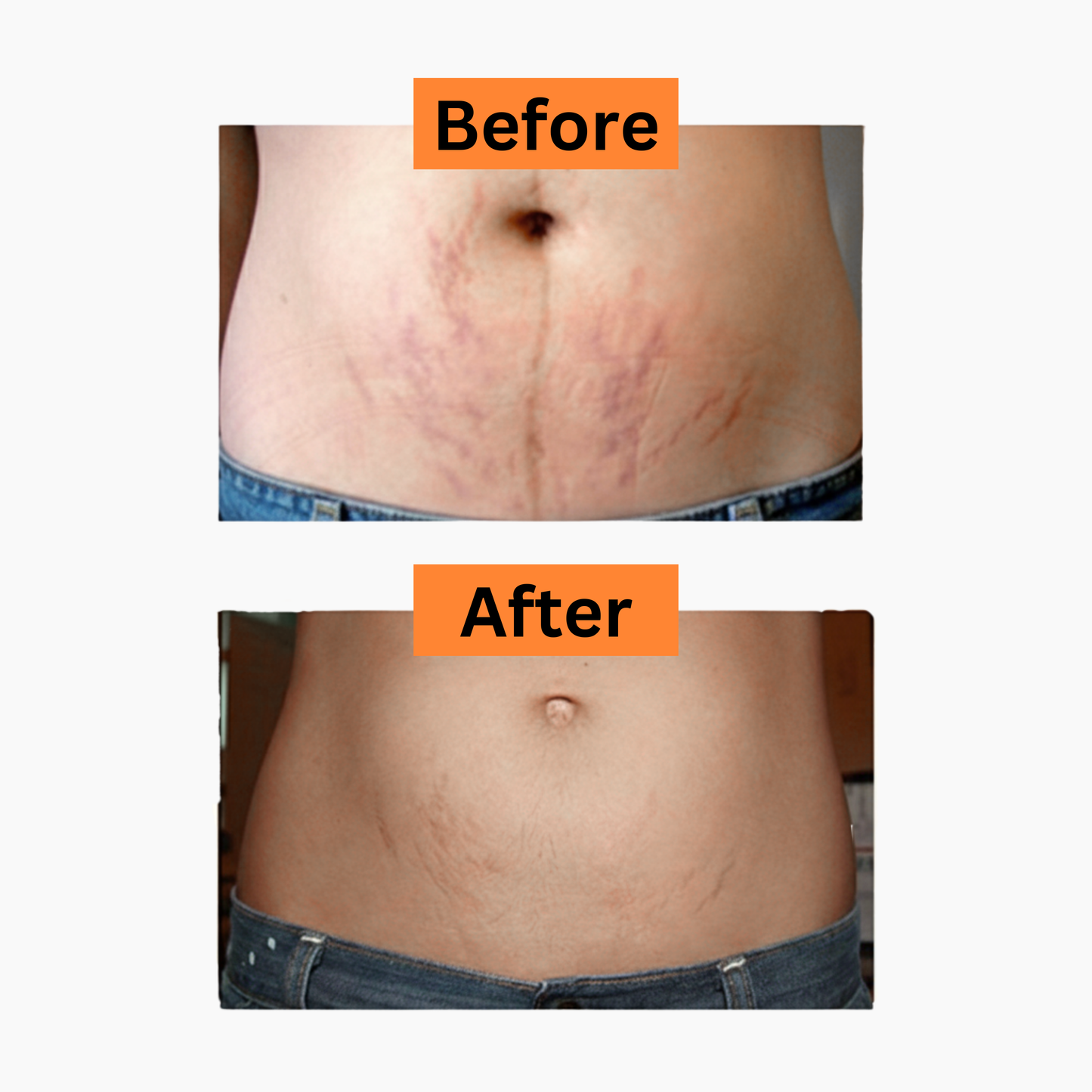 Get Your Body Back Tallow + Raw Honey Balm