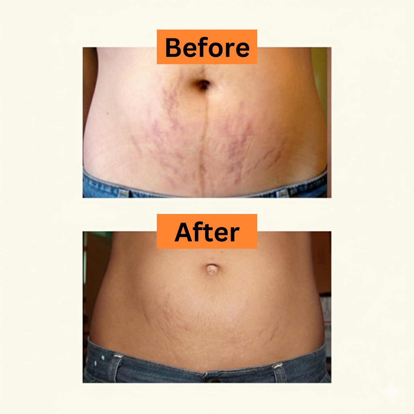 Get Your Body Back Tallow + Raw Honey Balm